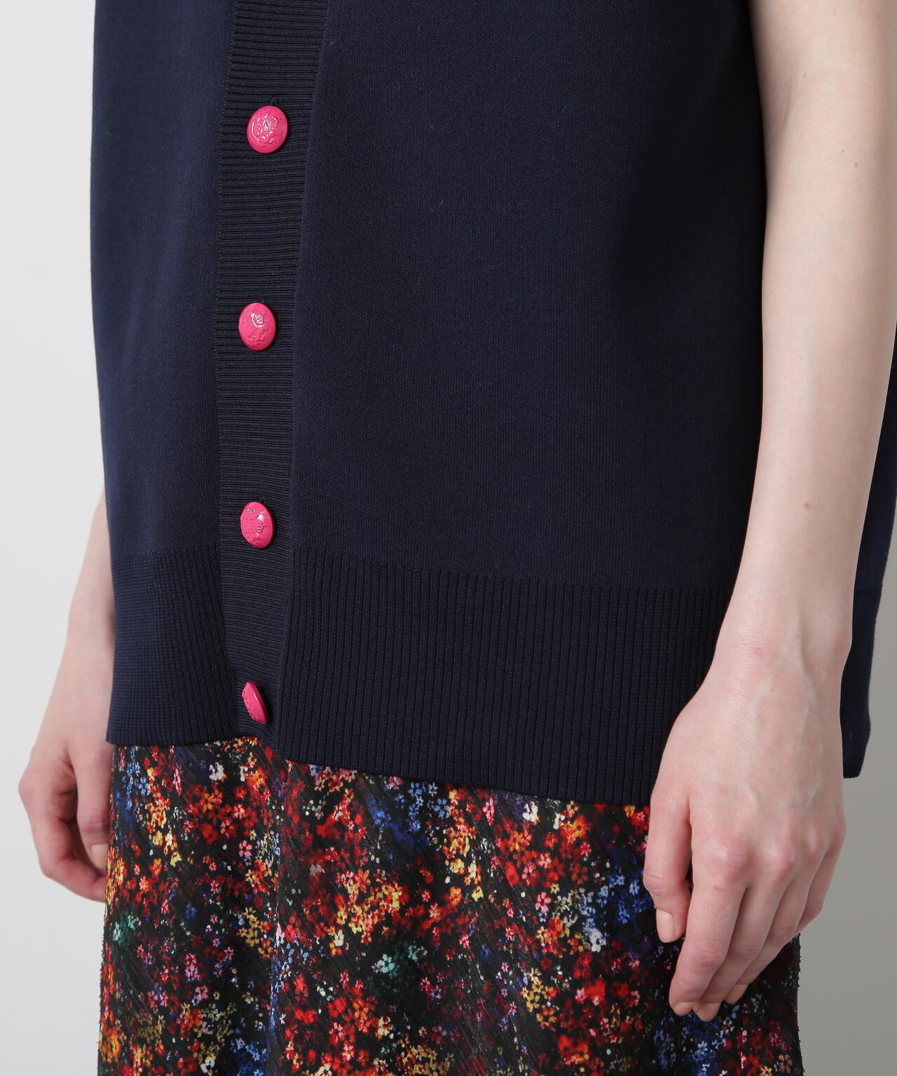 Painted Metal Button Gilet